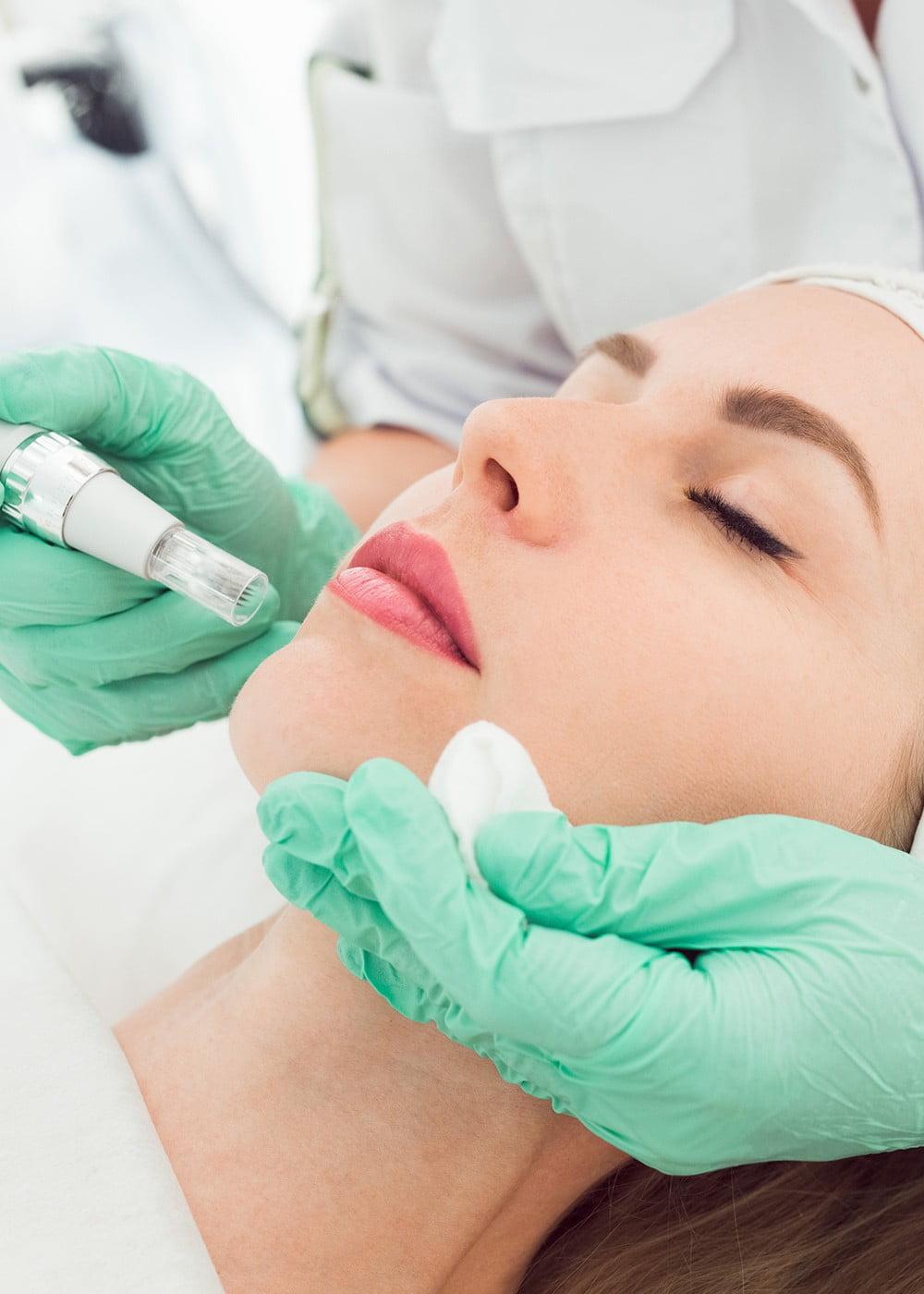 NSC-MICRONEEDLING