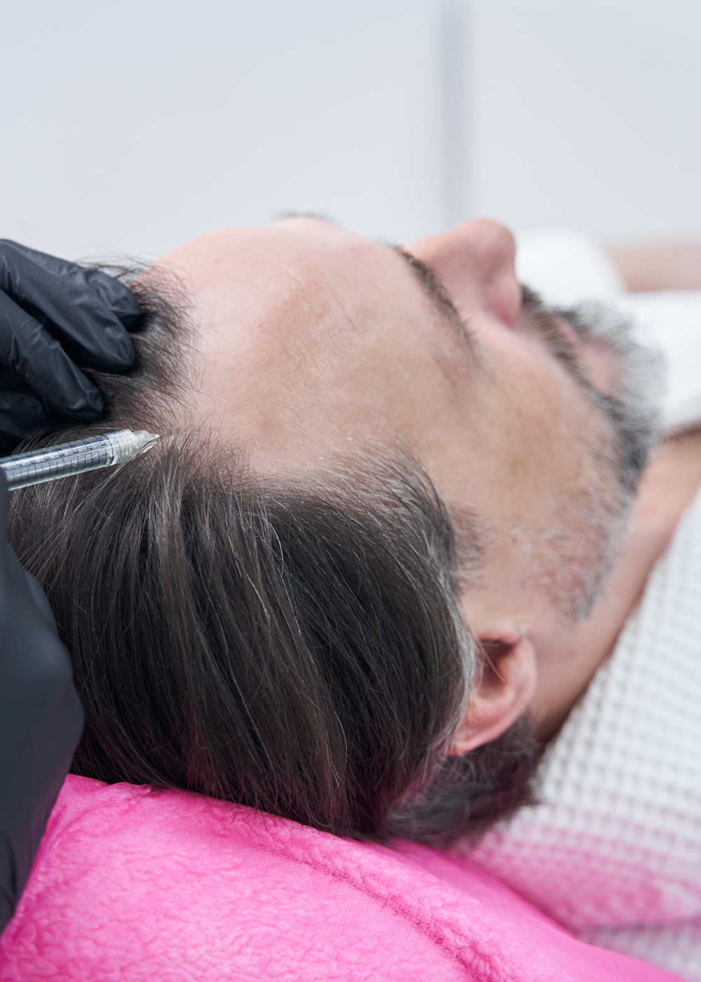 NSC-HAIRFILLER