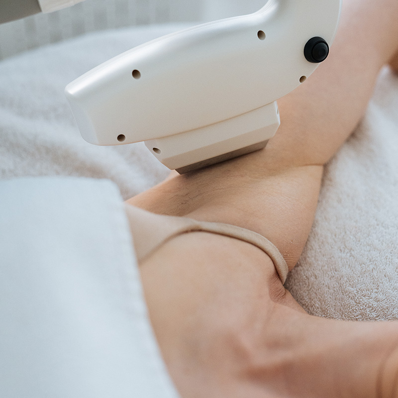 Laserbehandelingen-voor-definitief-ontharen-I-Beau-T